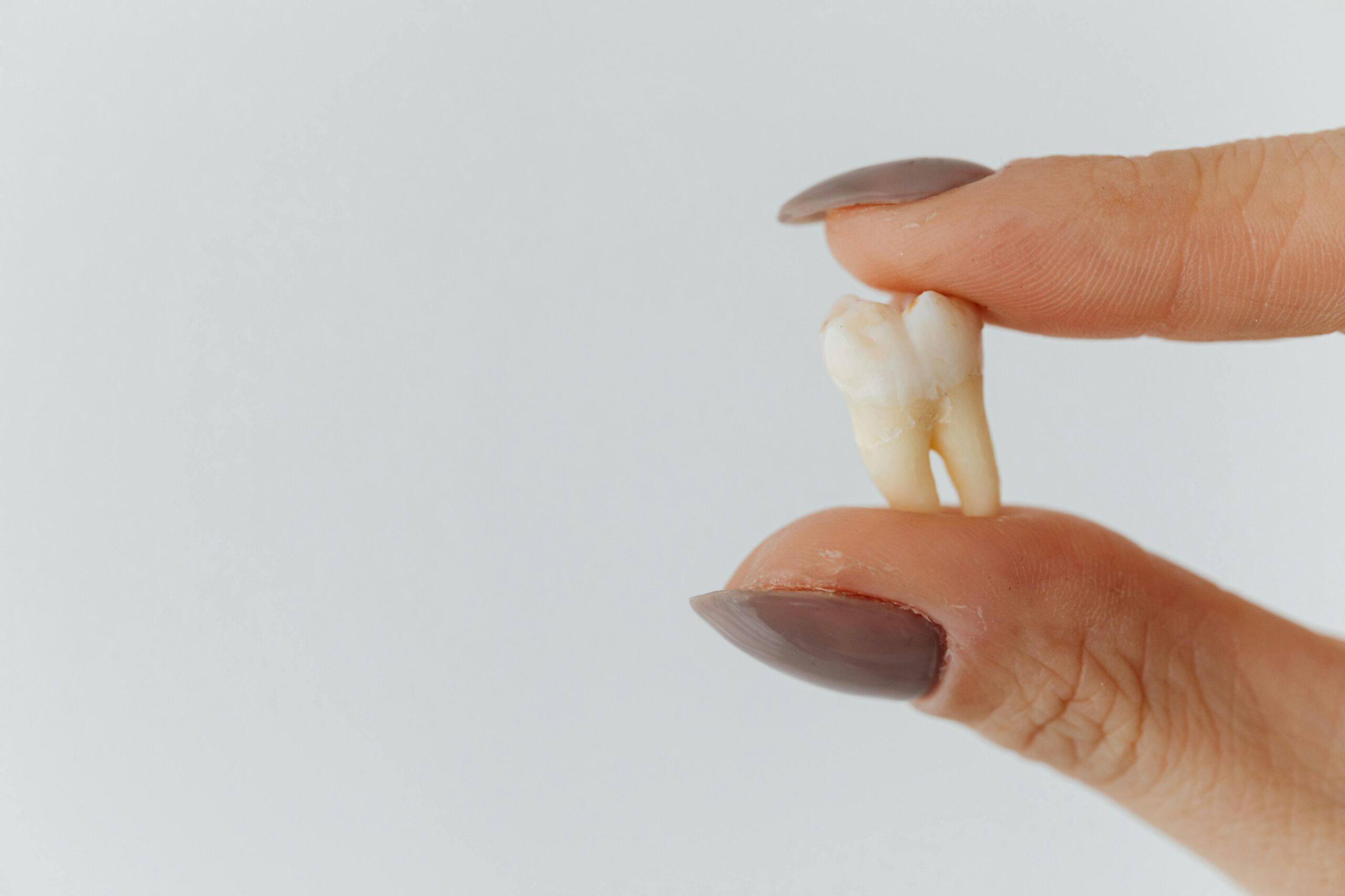 O que significa sonhar com dente caindo? Descubra aqui!